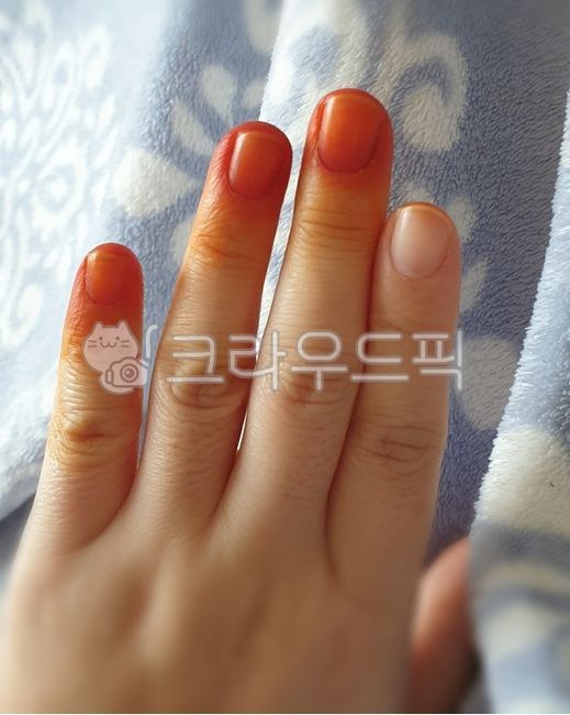 A)봉숭아꽃 물들이기 썸네일 3
